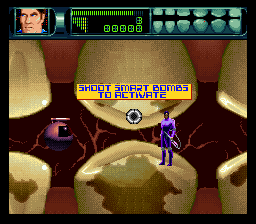 Play SNES Rex Ronan - Experimental Surgeon (USA) Online in your 